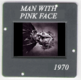 Man with Pink Face: CLICK TO VIEW PHOTOGRAPH